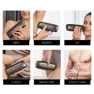 Ulike Rose IPL Hair Removal & Anti-Ageing Device