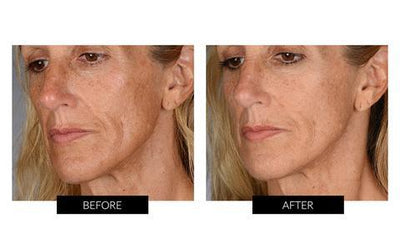 BeautyBio Skin That Glitters (worth $554)